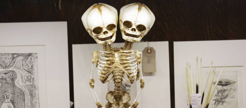 A two-headed skeleton